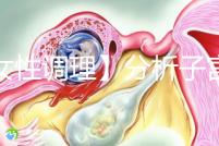 【女性調理】分析子宮壁薄的四個常見原因，教你三招對癥下藥可以快速改善！