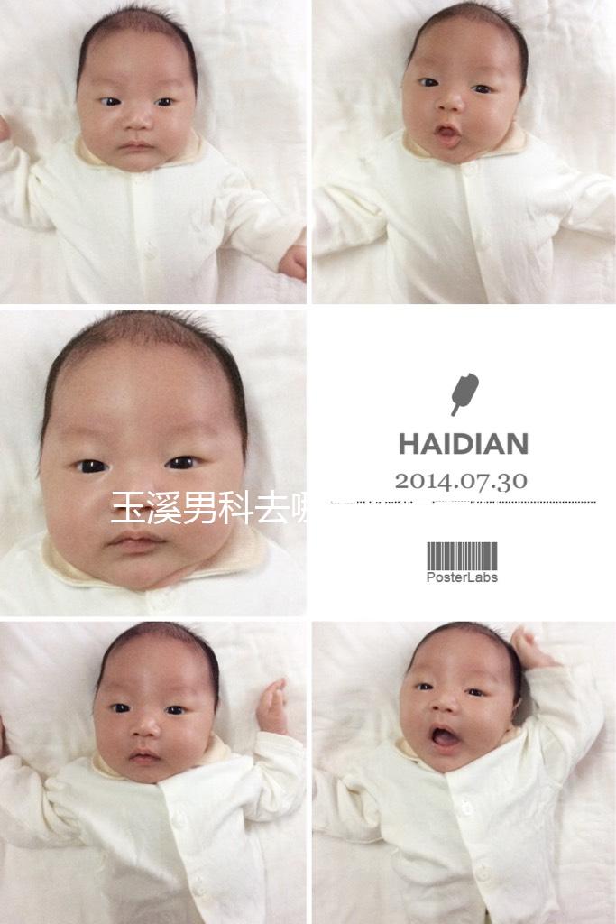 玉溪男科去哪家醫院看好，怎么選攻略，這個排行榜不要錯過