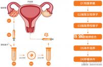 玉溪到昆華醫院做試管嬰兒怎么樣？詳細費用明細如下