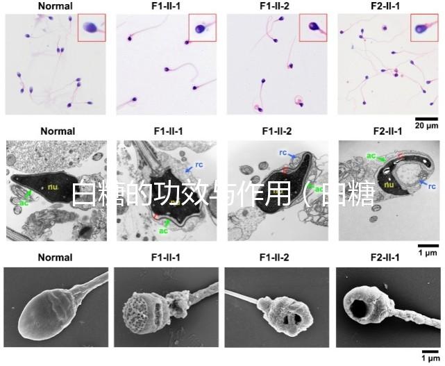 白糖的功效與作用(白糖的功效與作用及營(yíng)養(yǎng)價(jià)值)