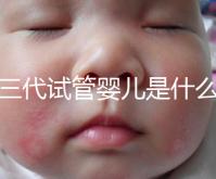 第三代試管嬰兒是什么意思