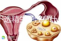 私下選精生子注意什么細(xì)節(jié)要早知，選擇正規(guī)機(jī)構(gòu)最重要