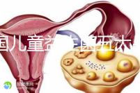 美國兒童益生菌五大品牌排行榜，康萃樂、家得路榜上有名