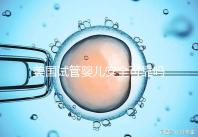 美國試管嬰兒安全可靠嗎？了解基本原理和安全性？