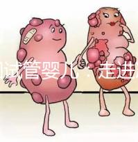 美國試管嬰兒：走進冷凍卵子技術