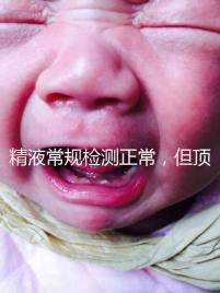 精液常規檢測正常，但頂體酶低，是否影響試管嬰兒成功率？