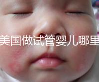 去美國做試管嬰兒哪里最好，4家好評輔助生殖機(jī)構(gòu)推薦