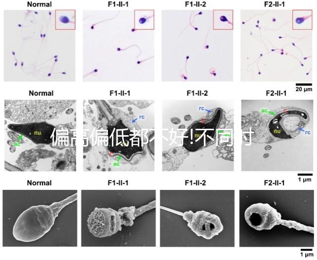 偏高偏低都不好!不同時期促卵泡成熟激素正常值一覽