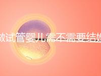 做試管嬰兒需不需要結(jié)婚證，做試管嬰兒是否需要結(jié)婚證
