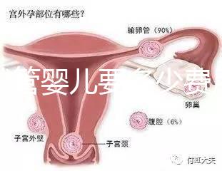 做試管嬰兒要多少費用(做試管嬰兒要多少費用?)