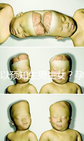 可以預知生男生女？孕婦夢見馬的胎夢解讀