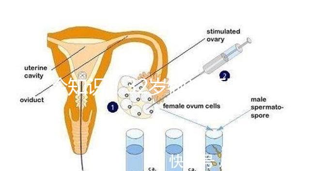 冷知識(shí)!32歲做試管嬰兒提升成功率的方法請(qǐng)收藏