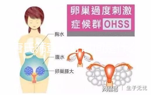 唐氏篩查最好時(shí)間是什么時(shí)候，內(nèi)蒙古單項(xiàng)費(fèi)用不超三百