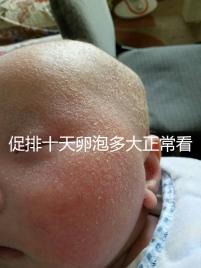 促排十天卵泡多大正?？催@，1.1×0.9符不符合一文說清