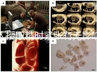 人授取精時(shí)緊張有無(wú)影響別還不造，注意事項(xiàng)不少不可不知