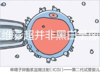 二維彩超并非黑白呈像，通過檢查還能看清胎兒五官