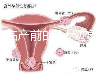二胎臨產(chǎn)前的7大跡象，出現(xiàn)見(jiàn)紅、陣痛別大意
