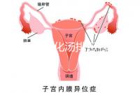 產(chǎn)后喝生化湯排惡露會(huì)使寶寶拉肚子？醫(yī)生：時(shí)間沒(méi)用對(duì)