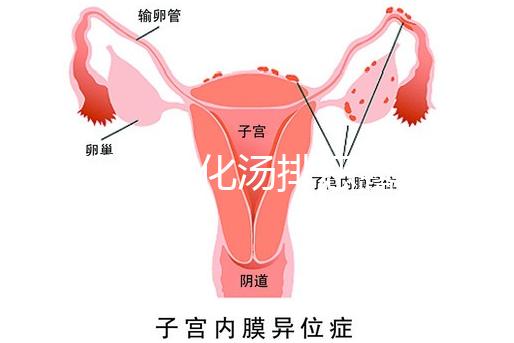 產(chǎn)后喝生化湯排惡露會使寶寶拉肚子？醫(yī)生：時間沒用對