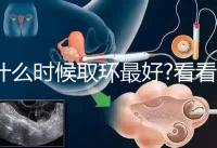 什么時候取環最好?看看各地姐妹們有什么經驗之談