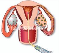 什么時候懷孕容易受孕？