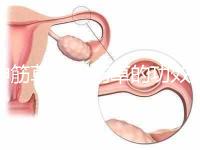 伸筋草（伸筋草的功效作用與主治）