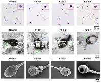 為何試管嬰兒都不順產（為何試管嬰兒都不順產呢）