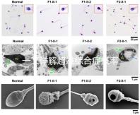 一文詳解超雄綜合癥概率有多大，想造的人多不多看過來