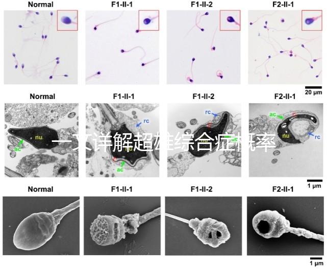 一文詳解超雄綜合癥概率有多大，想造的人多不多看過(guò)來(lái)