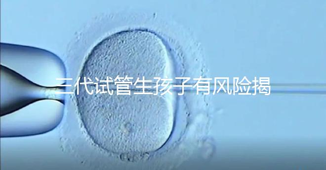 三代試管生孩子有風險揭秘嗎？嬰兒會有問題嗎？