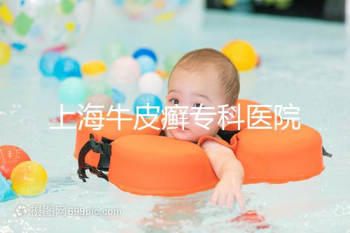 上海牛皮癬??漆t院