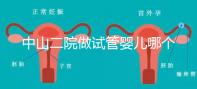 中山二院做試管嬰兒哪個(gè)醫(yī)生好？附醫(yī)院試管成功率
