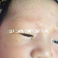 想知道促排期間能不能吃草莓看過來，怎么吃不發(fā)胖有講究