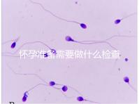 懷孕準備需要做什么檢查對優生優育有幫助