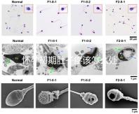 懷孕初期肚子疼該怎么處理