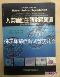 揭示抑郁癥做試管嬰兒會遺傳給女兒，想避免看這個