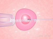 染色體XXY鬧劇：克氏綜合征，帶你走進“第三性別”群體