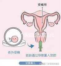 柳州幾個醫院能做第三代試管嬰兒？詳細的費用成功率都在這