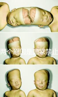 有兩個原因是國家禁止中非混血中國會接受嗎？