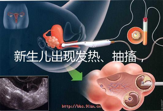 新生兒出現發熱、抽搐，很可能是胎毒的表現