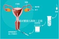 正規試管嬰兒醫院（正規試管嬰兒醫院排名）