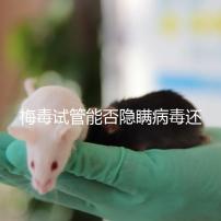 梅毒試管能否隱瞞病毒還沒有建造，備案記錄已經通知