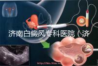 濟南白癜風(fēng)專科醫(yī)院（濟南白點癲風(fēng)醫(yī)院排名）