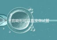 子宮畸形可以直接做試管嬰兒？醫(yī)生說(shuō)，應(yīng)先治療！