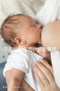 子宮動脈血流和胚胎著床關系很大,這些知識你了解嗎？