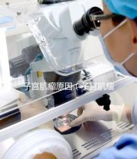 子宮肌瘤原因（子宮肌瘤原因有哪些）