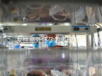 女性意外懷孕的表現是什么？