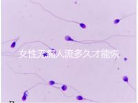 女性無痛人流多久才能恢復健康？