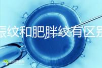 妊娠紋和肥胖紋有區別，教你3種“花紋”診斷鑒別的方法