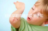 妊娠早期疼痛的異常表現是什么？